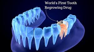 Alt ="Tooth Regrow"